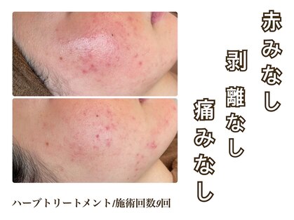 ミー(美mee)の写真