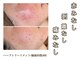 ミー(美mee)の写真