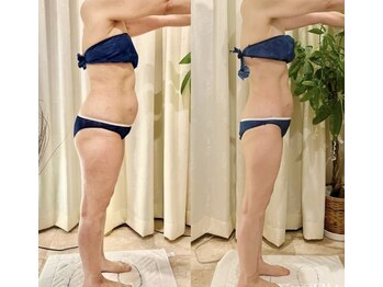 コリオ(KoRiO)/痩身3回目のお客様［狭山ヶ丘］