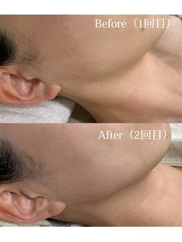 メイス 福井店(MEIS)/お客様Before、After