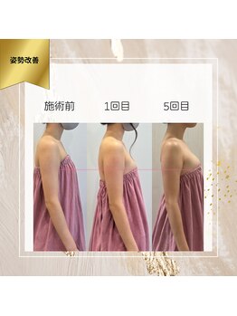 ロココ 町田店(Rococo)/5回で上向きバストに!