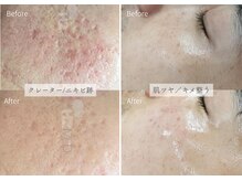 シューラディアント(ShuRadiant)の雰囲気（あらゆる悩みに対応/結果にこだわったエステサロンです）