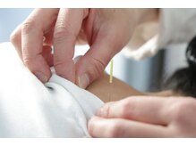 鍼・マッサージ・まつ毛パーマ ほがらかの雰囲気(鍼マッサージは不調に合わせてコースをお選びいただけます!)