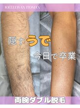 ジョエルワックス 沖縄糸満店(JOELLE WAX)/両腕ダブル脱毛