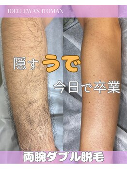 ジョエルワックス 沖縄糸満店(JOELLE WAX)/両腕ダブル脱毛