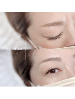 リヨン(LYON+831)/