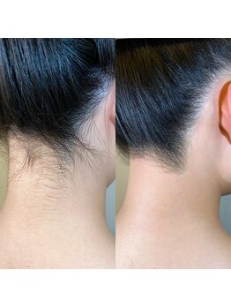 ロージー(Roziy)/うなじワックス