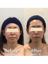 小顔フェイスラボ 瀬田店(小顔 Face Labo.)/小顔＆整体コルギの変化