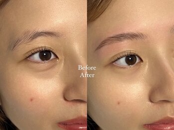 ノーツ 亀有(naut)/HBL 眉癖改善