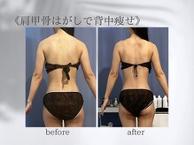 ジュプン 長崎/ブライダルエステ