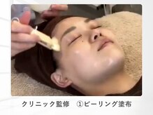 ルナティアラ(LUNAティアラ)/ピーリング（角質除去）