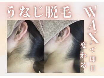 アルゴ 金沢増泉店(ALGO)/うなじ脱毛