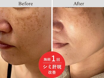 アールーム(Room)/