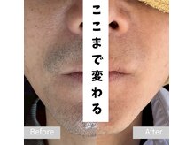 ティアレ 緑井店(Tiare)