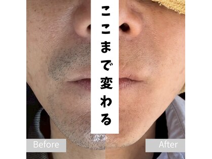 ティアレ 緑井店(Tiare)の写真