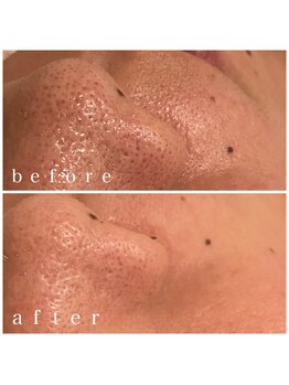 メナードフェイシャルサロン 岐阜茜部/毛穴ケア/くすみ/透明感