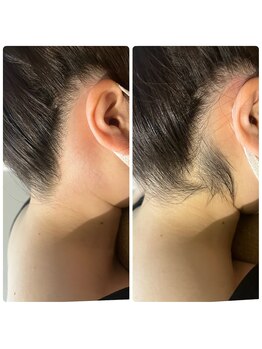 十美/【後ろ美人♪】before　after