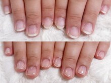 グレースレディ 大阪店/(深爪/長さだし/フィルイン)