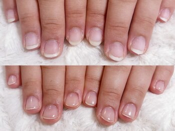 グレースレディ 大阪店/(深爪/長さだし/フィルイン)