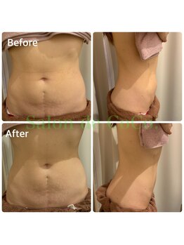 サロンドココ(Salon de CoCo.)/美腸ケアコース前後