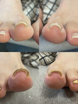 アイラスジュニア(AILAS.Jr)/