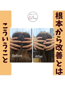 美顔デザインsuu.~若見えと歪み矯正専門の小顔サロン~/Before-After【30代】1回