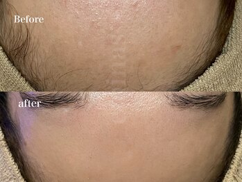 エミナス(EMINAS)/ざらつき、くすみ撃退！