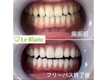 ルブラン 奈良店(Le Blanc)/ご予約お待ち致しております♪