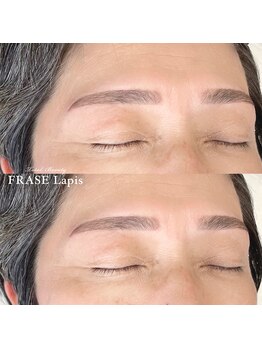 フレイズラピス(FRASE Lapis)/ハリウッドブロウリフト