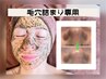 【黒ずみ・角栓いちご鼻専用】毛穴丸ごと強力洗浄付ハーブピーリング¥15400→