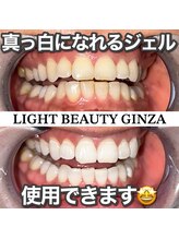 ライトビューティー 銀座店(LightBeauty)/東銀座　ホワイトニング症例写真