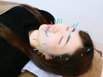 ウル鍼灸整骨院/美容鍼スタンダードコース