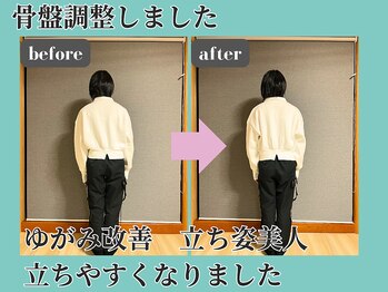 シェノン(Chainon)/骨盤調整