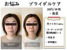 6月～スタート【結婚式を控えているあなたへ】極・美容鍼　¥19,800→¥3,980