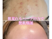 エレナ(ERENA)