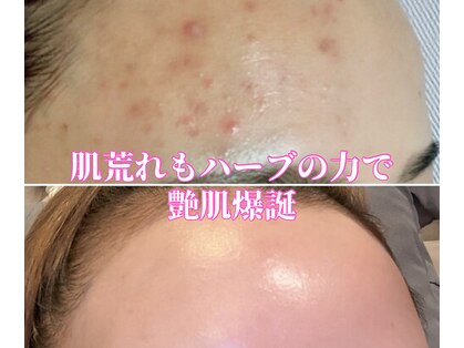 エレナ(ERENA)の写真