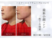 ユアーズ ビューティー(YOURS beauty)/1回で驚きの小顔へ☆