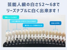 スマイルホワイト 練馬店の雰囲気（歯科提携ジェル×通い放題で理想の白さを実現します♪）