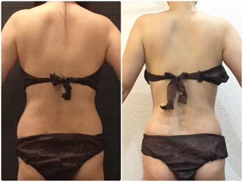 美容整体ウェリナ あま甚目寺院/小顔矯正/骨盤矯正/美脚サロン