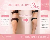 ヨサパーク エルメ 経堂(YOSA PARK Herme)