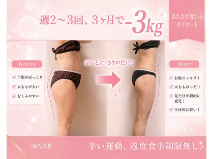 ヨサパーク エルメ 経堂(YOSA PARK Herme)の写真