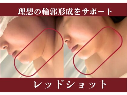 ビースキン 広島(BE:SKIN)の写真