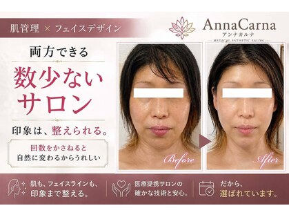 アンナカルナ(AnnaCarna)の写真