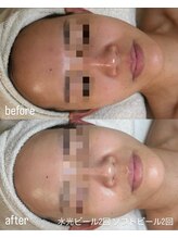 フロル(FLOR)/FLOR【根本改善専門店】