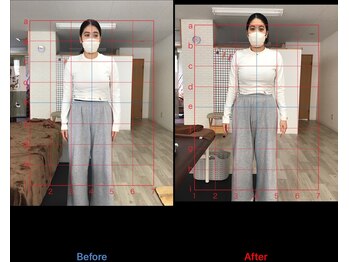 ストレチックス 近江八幡店/BeforeAfter
