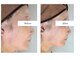 サロン ド ハニー(Salon de Honey)の写真