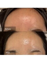 マインエム(mine.m)/SEN管理