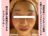 No,1★【たるみ・シワ・ほうれい線】小顔フェイシャル×首肩ほぐし付60分