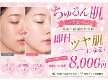 モアフェイス 池袋店(More Face)の写真/頑張った私にご褒美！顔のクスミさよなら！ララピールとよもぎ蒸しと小顔矯正で即日ツヤ肌・小顔へ♪