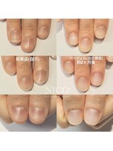 ニコプラス(NICO+)/深爪育成パラジェルクリア補強